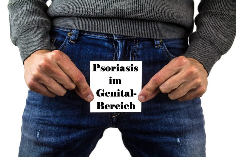 Genital-Psoriasis – (k)ein Grund, sich zu schämen