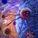 Erhöhtes Risiko bei Psoriasis: Kann Schuppenflechte Krebs auslösen?