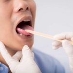 Wenn Schuppenflechte Lippen und Mund betrifft: Symptome, Ursache und Behandlung