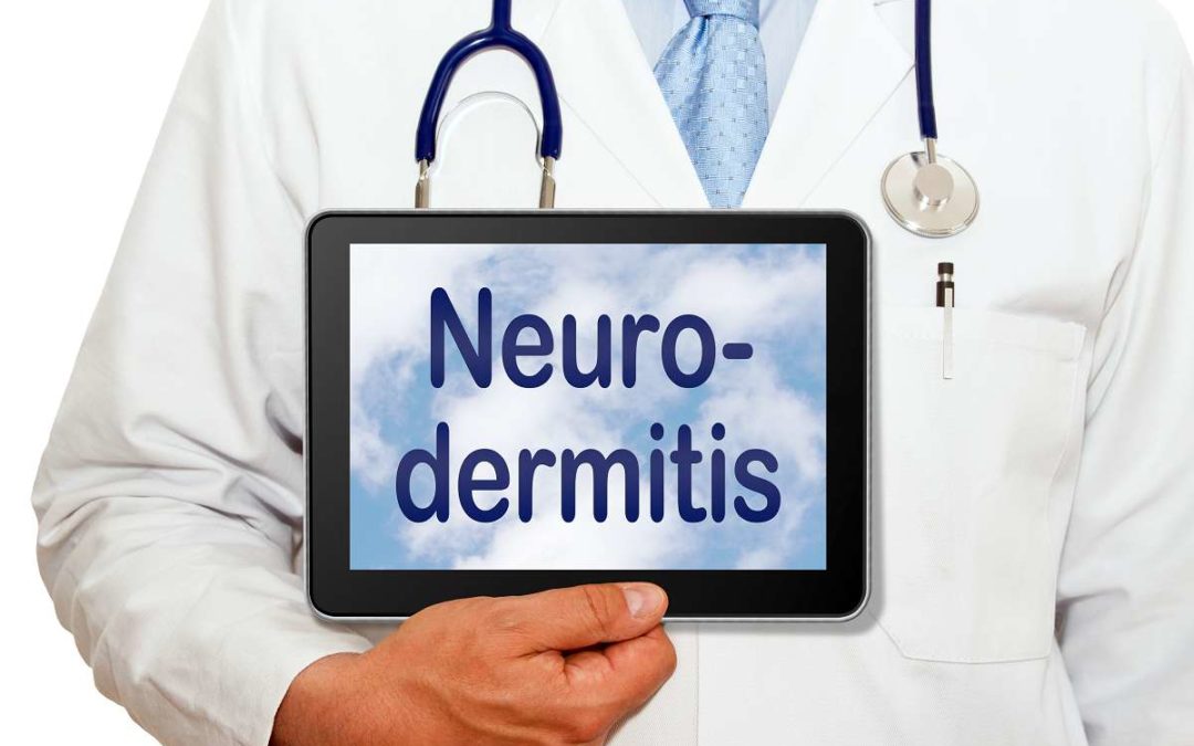 Neurodermitis Ursachen und Auslöser